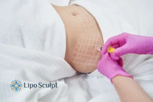 Are The Results From Aqualyx Permanent? 1 Do you want to know how long Aqualyx Ashby Parva results last?