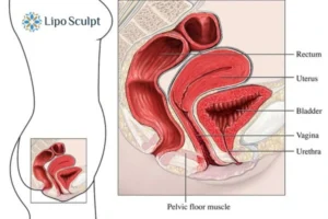 Treatment For A Leaky Bladder 2 How EM Chair treatment Ashby Parva can help Leaky bladder issues. Read more now!