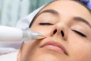 Best Actinic Keratoses Removal 3 Actinic keratoses Ashby Parva solutions - book in today!