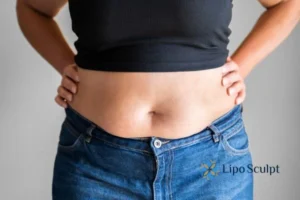 Bidding Farewell to Muffin Tops with Aqualyx Fat Injections 2 Do you wish you could reduce your muffin top Ashby Parva With Aqualy fat dissolving injections you can!