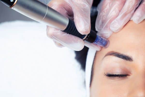 Explaining Total Skin Tightening Treatment and What to Expect 2 What Skin Concerns Can Total Skin Tightening Treatment Help With Ashby Parva?