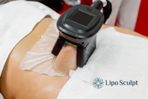 Does Fat Freezing At Home Work? 3 Fat freezing at home from Lipo Sculpt Ashby Parva