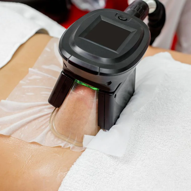 Fat Freezing treatment Ashby Parva